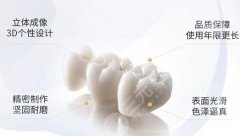 烤瓷牙能用多久？价格+术后注意事项分享，重获魅力笑颜！