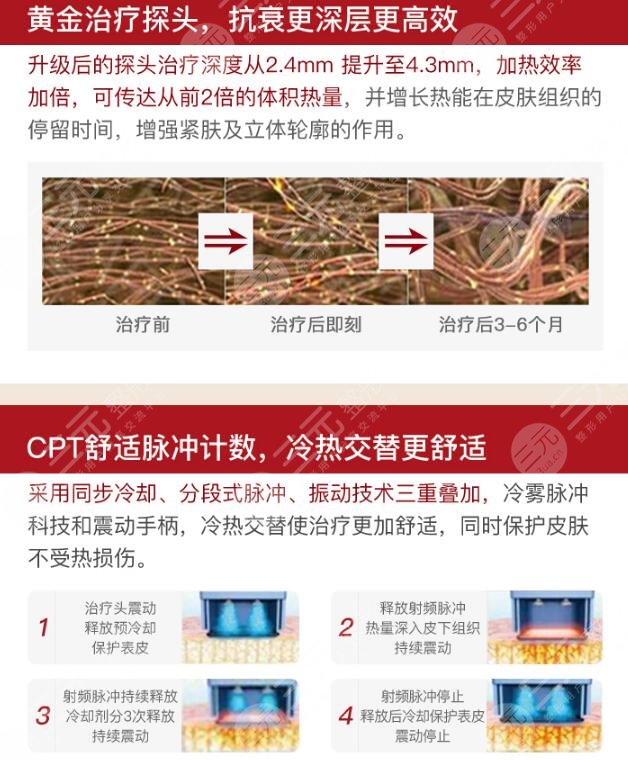 热玛吉简介