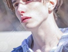 如何去除脸上的色斑?激光祛斑优势及果 如何去除脸上的色斑?激光祛斑优势及果