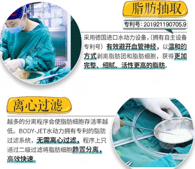 自体脂肪移植丰胸需要注意事项
