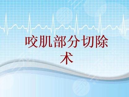 咬肌切除手术是什么?