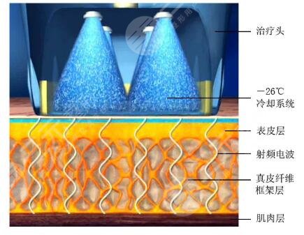 vkoor抗衰优势解析~