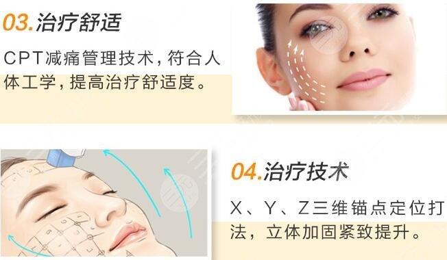 新一代热玛吉果 优点