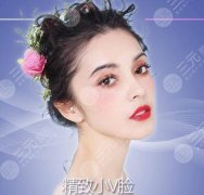 打玻尿酸垫下巴能维持多久？要注意什么？绝美侧脸就靠ta，必看攻略！