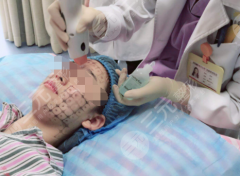 热玛吉是什么美容项目?手术时间|注意事项详解! 热玛吉是什么美容项目?手术时间|注意事项详解!