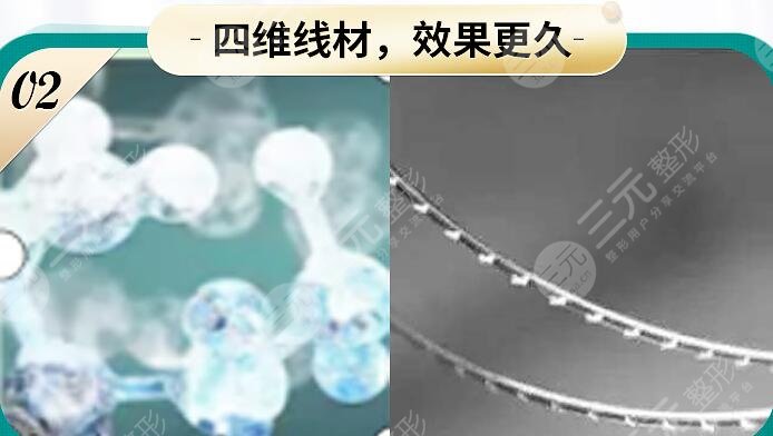埋线面部除皱手术