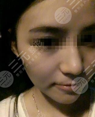 热玛吉