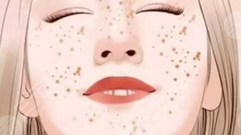 激光美白祛斑多少钱?