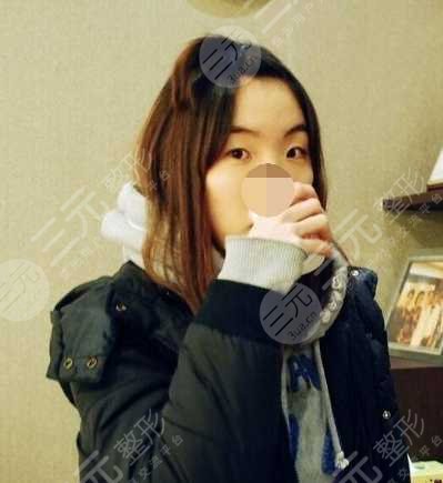 手术前