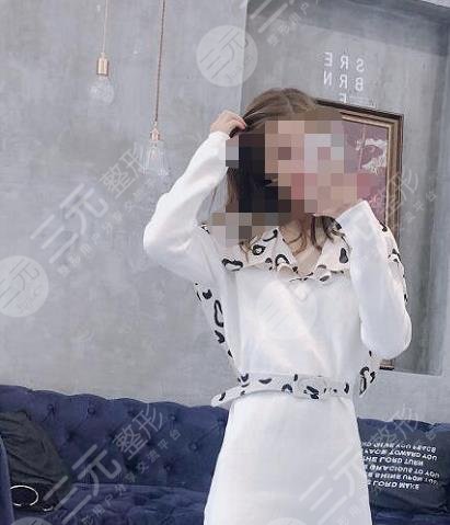 抽脂手术后