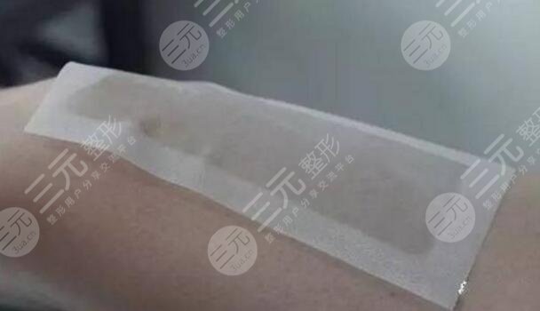 蜜蜡脱毛
