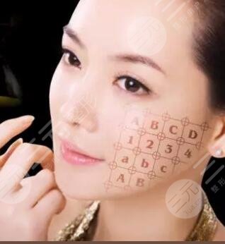热玛吉