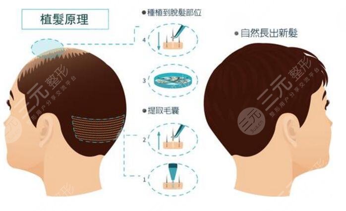 ptt多层数据加密植发