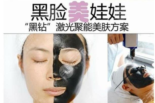 什么是黑脸娃娃？