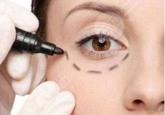 去眼袋手术报价一览！费用大概多少钱？“对症下药”才有！