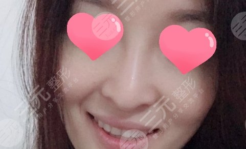 广州时光侯振杰医生怎么样？牙齿矫正果真是太好了！