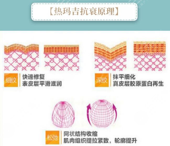 热玛吉1200发和900发的区别 原理