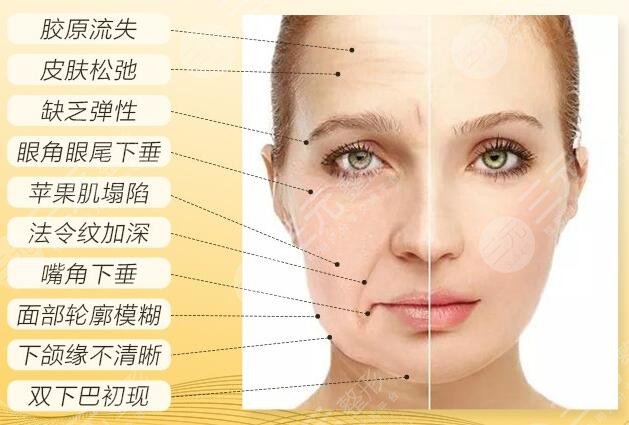 热玛吉1200发和900发的区别