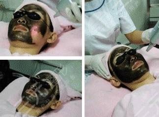 黑脸娃娃嫩肤果、危害