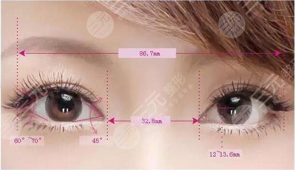 8mm双眼皮恢复后是多宽
