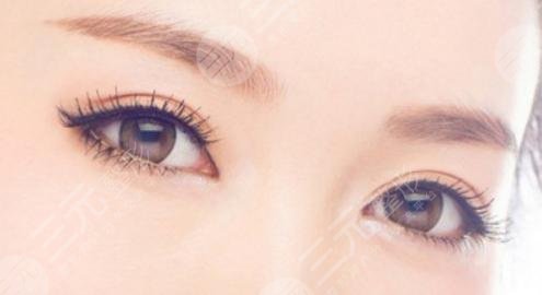 8mm双眼皮恢复后是多宽