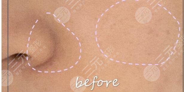 黑脸娃娃果参考