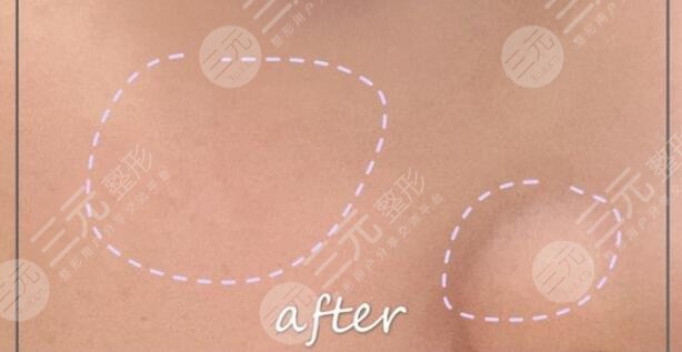 黑脸娃娃缓解果