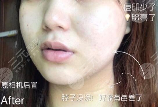 黑脸娃娃嫩肤体验果