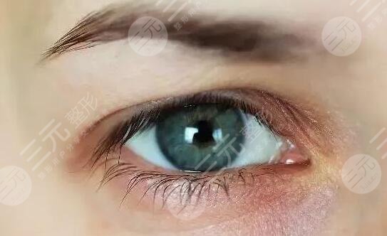 单眼皮好还是双眼皮好呢?