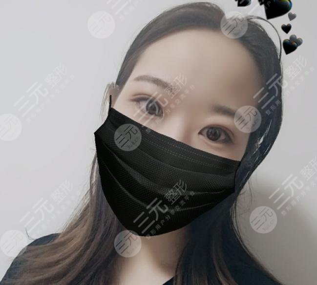 兰大二院整形科专家双眼皮案例