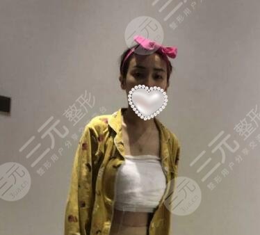 西安西京医院整形张兆祥隆胸案例图