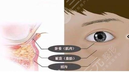 注射一支玻尿酸就能打造撒娇肉