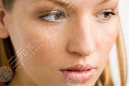 光子嫩肤后的注意事项