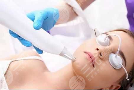 光子嫩肤后的术后护理