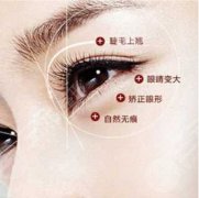 韩式翘睫双眼皮的优势，给爱美姐妹一一详细列出来了！