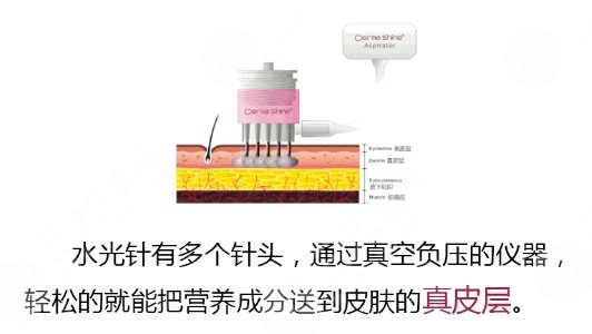 光乳化去眼袋和注射补水一样吗？医美小白必看科普！