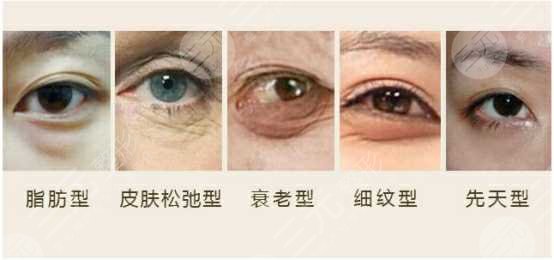 光乳化去眼袋和注射补水一样吗？医美小白必看科普！