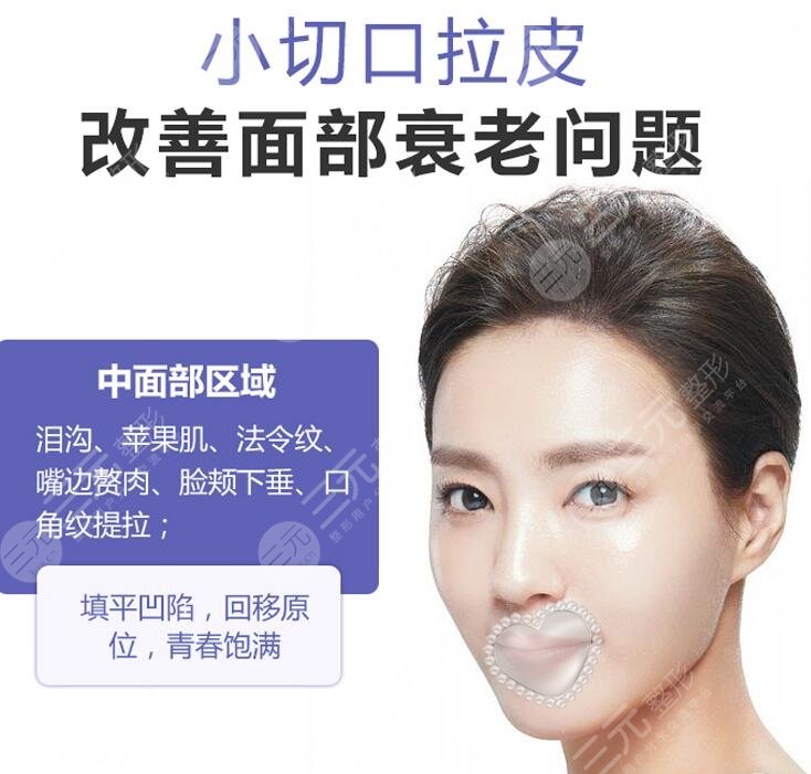 微创面部除皱的价格费用是多少?降低风险吗?来瞧瞧科普! 微创面部除皱的价格费用是多少?降低风险吗?来瞧瞧科普!