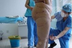 夺命萝卜腿！有什么方法可以瘦小腿？美腿的秘密公开！