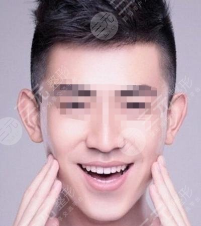 男生打注射瘦脸