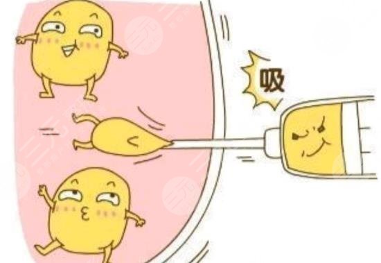 全身吸脂需要多少钱