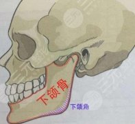 磨下颌骨要多少钱？手术进行前后应该注意哪些？