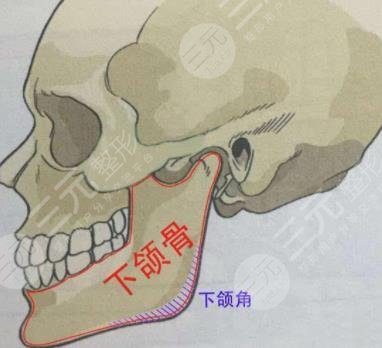 磨下颌骨要多少钱?手术进行前后应该注意哪些?