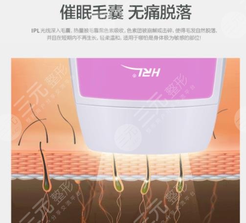 光子除毛成好吗