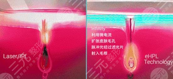 注意事项