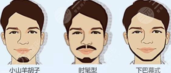 胡须种植适合哪些人群？