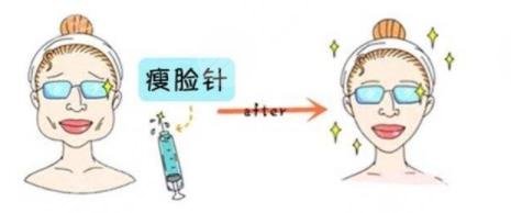 注射瘦脸作用
