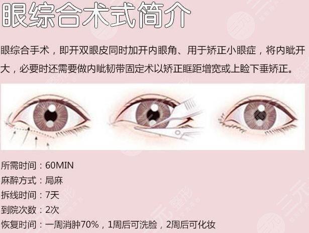 什么是双眼皮多项整形