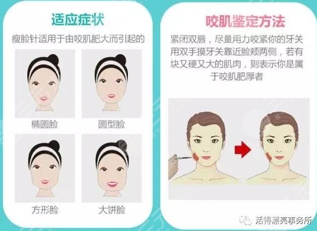 注射瘦脸适合人群