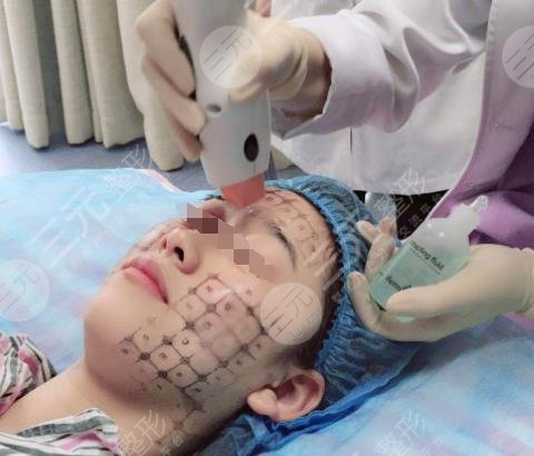 热玛吉全脸一次多少钱